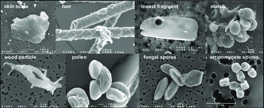 Coronavirus e inquinamento particelle al microscopio